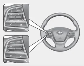 Hyundai Accent steering wheel audio control buttons layout Type A